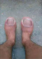 big toe